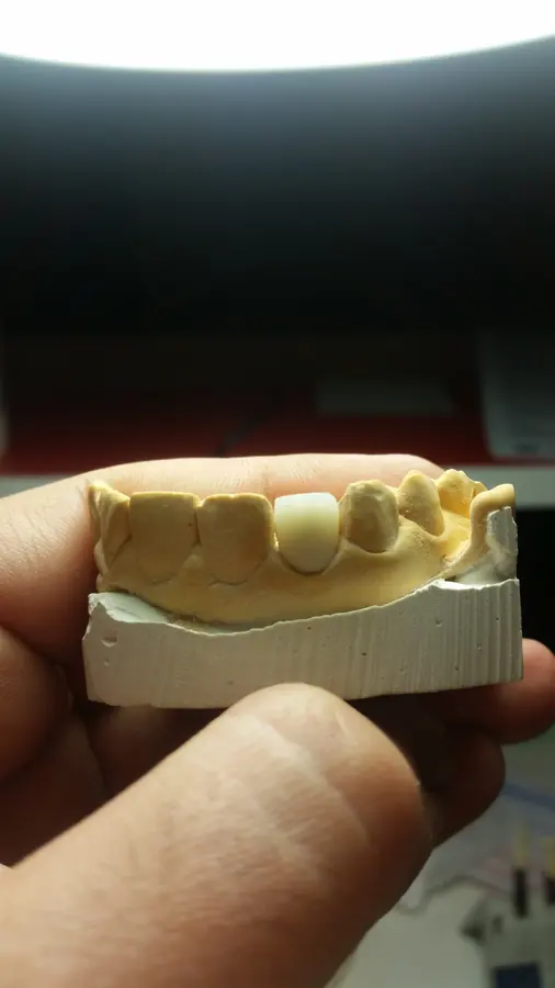 Müşteriden gelen ürün işleri 036