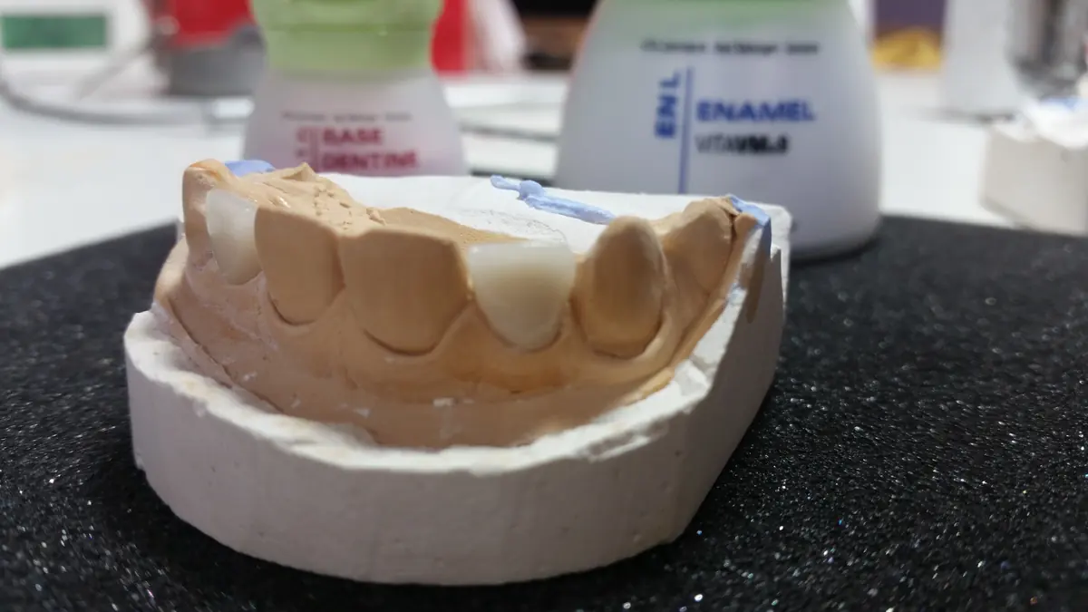 Müşteriden gelen ürün işleri 054