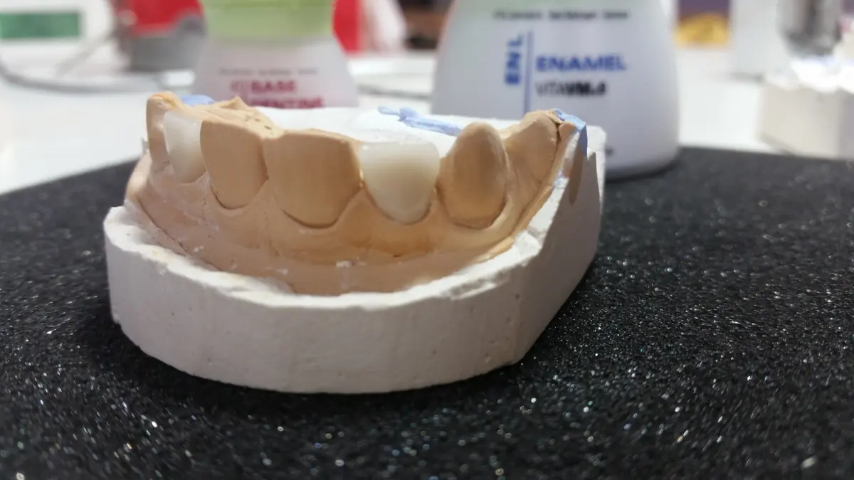 Müşteriden gelen ürün işleri 055