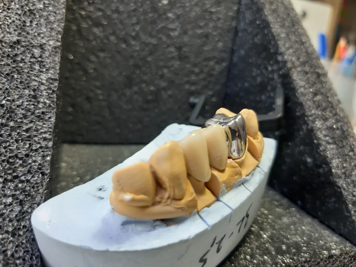 Müşteriden gelen ürün işleri 084