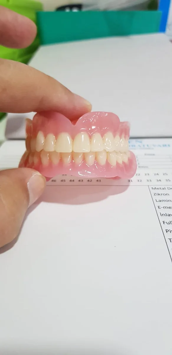 Full Ceramic Crown